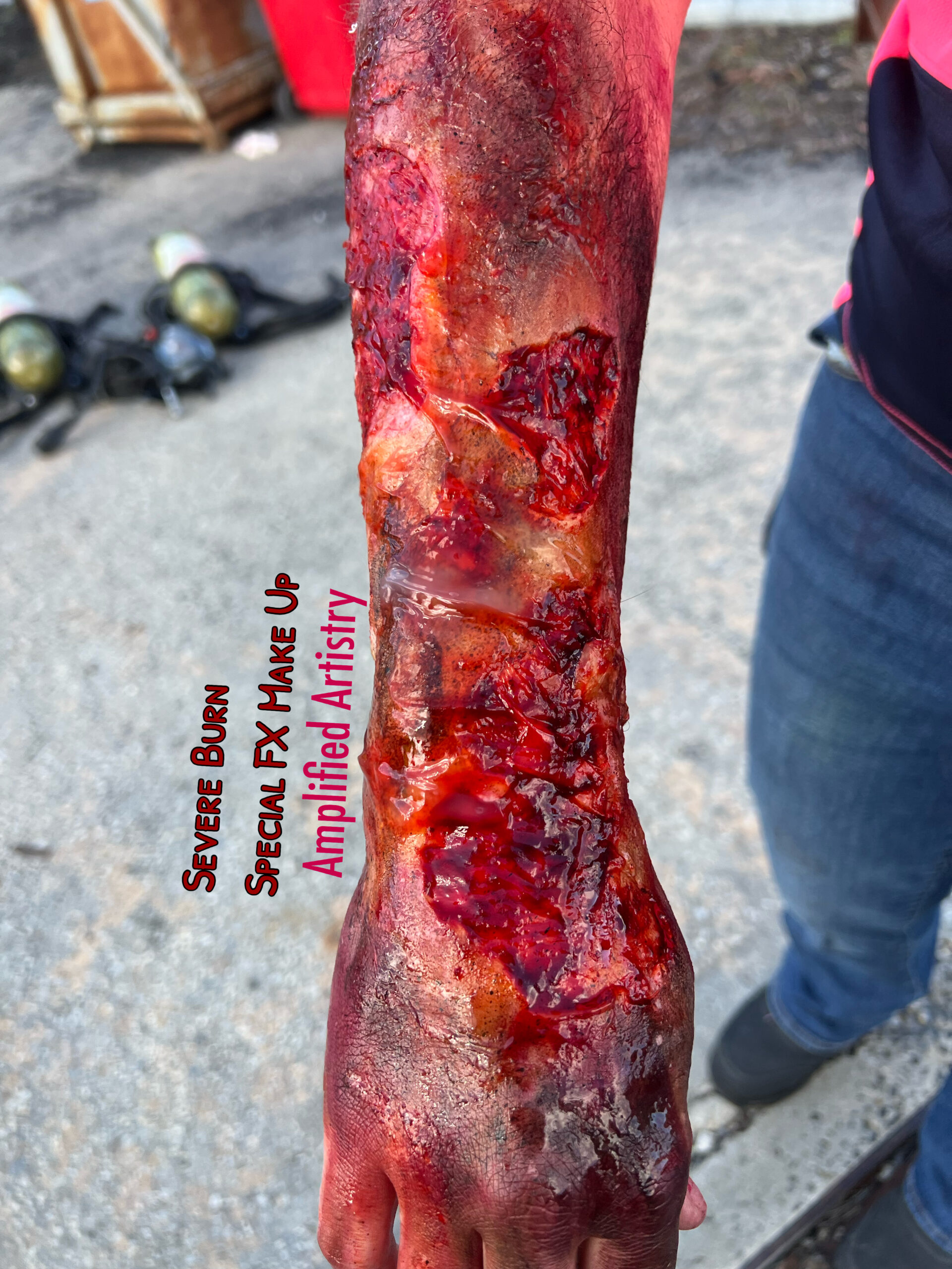 3rd degree Burn by Richelle @ Amplified Artistry Special FX Make up